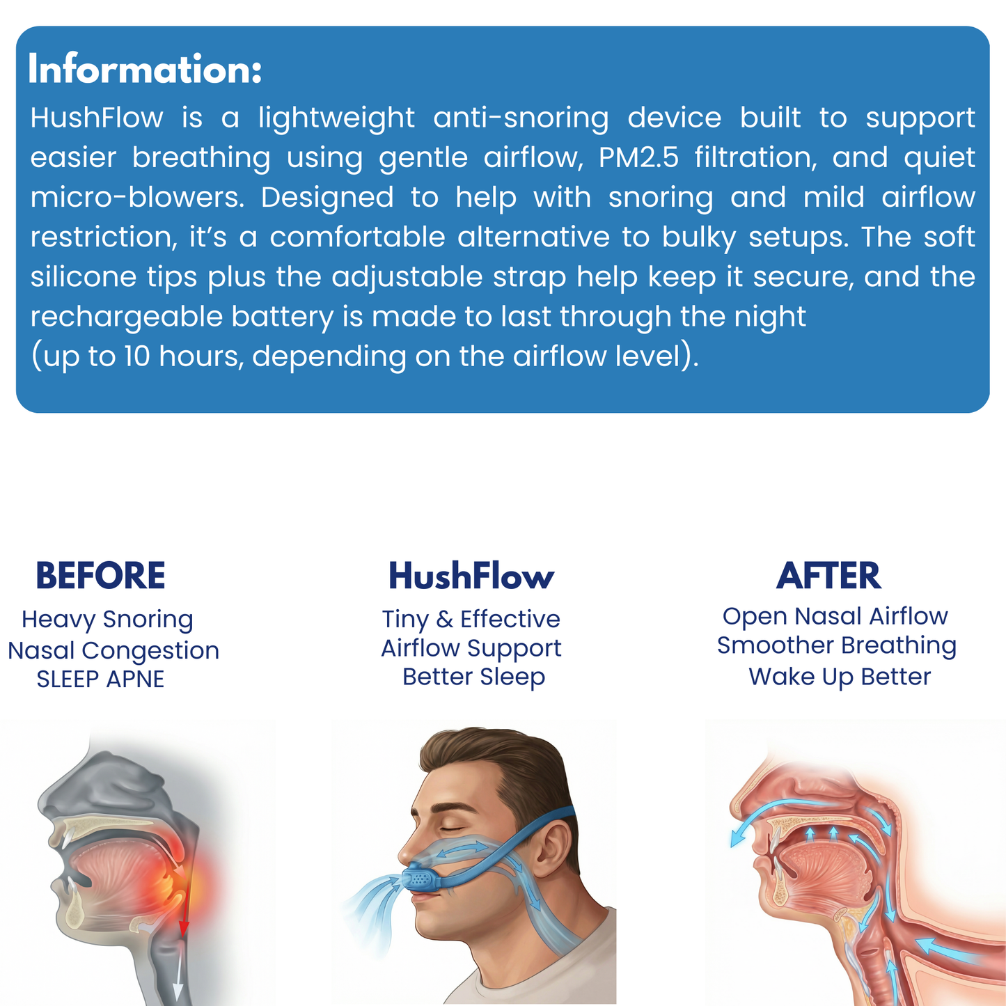 HushFlow Anti-Snoring